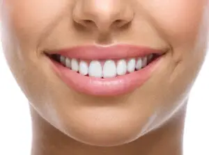 Read more about the article Teeth Whitening Perth | 5 Recommended Clinics for a Brighter Smile in 2024